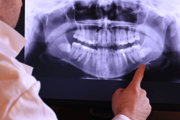 Best Emergency Dental Services for Seniors in Bloomingdale, FL