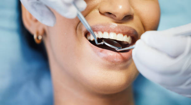 Best Emergency Dental Extractions in Bloomingdale, FL